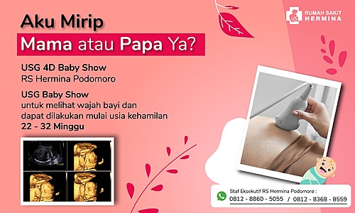 USG 4D Baby Show RS Hermina Podomoro 